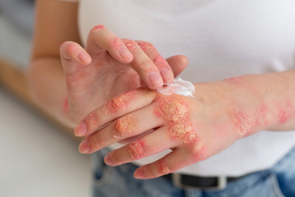 How Dermatologists Treat Allergies, Rashes, and Skin Conditions